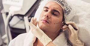 Facelift